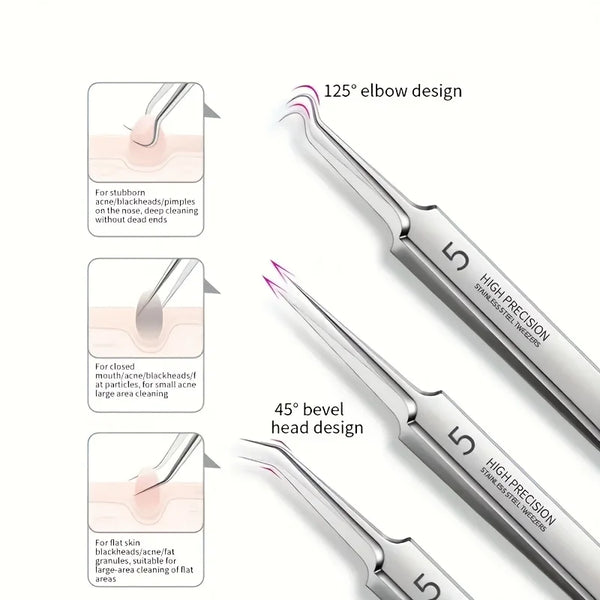 ProSkin Stainless Pimple Extraction Kit
