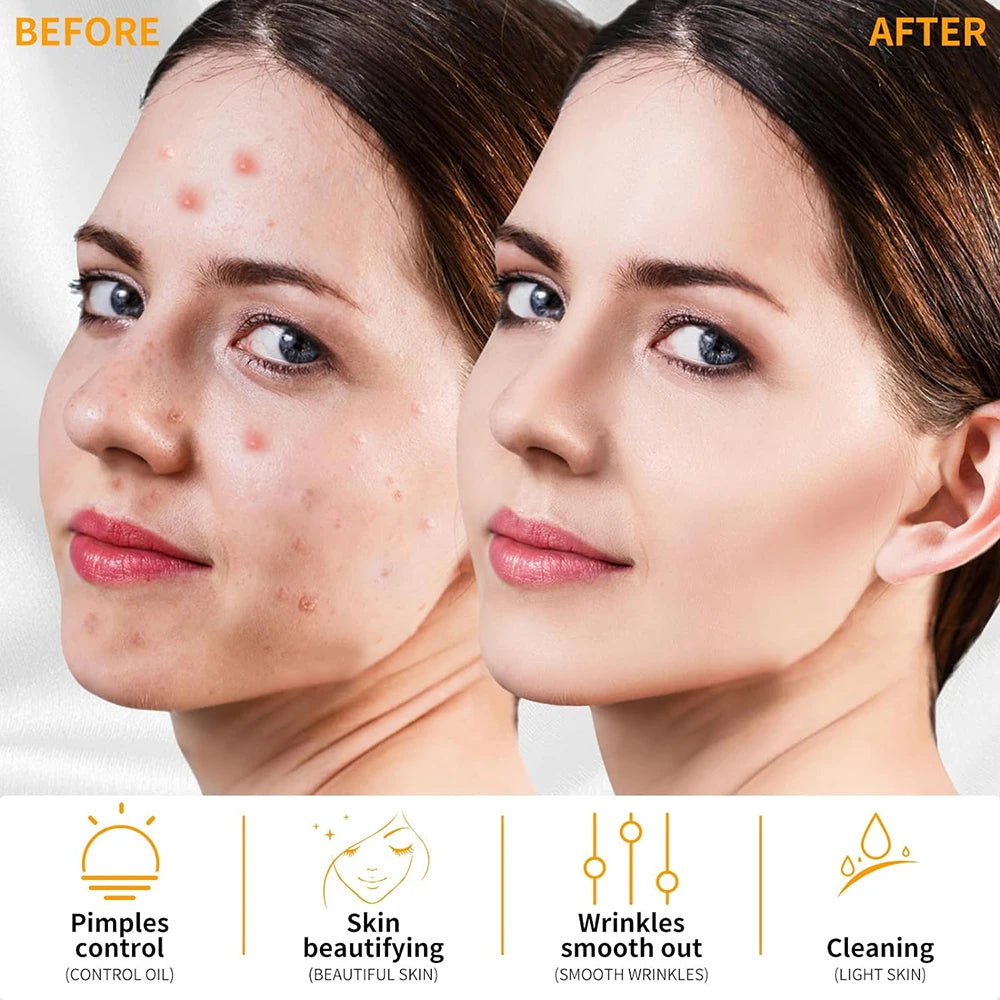 GlowBoost Facial Wand