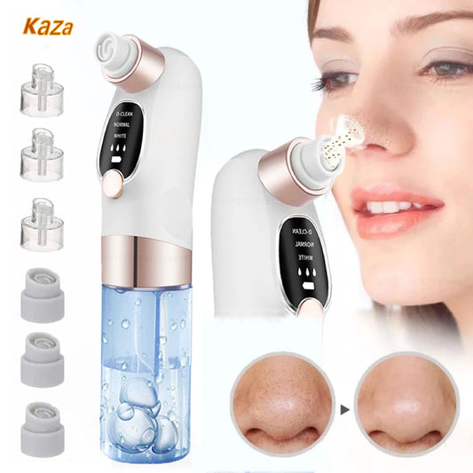 Ultimate Blackhead Buster