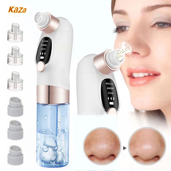 Ultimate Blackhead Buster